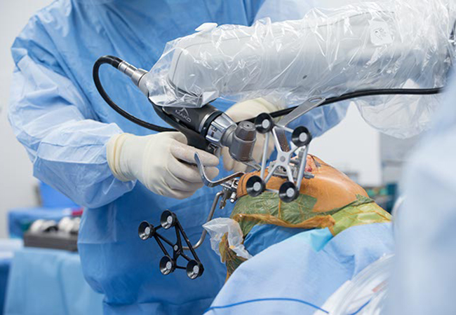 robotic knee surgery bhopal