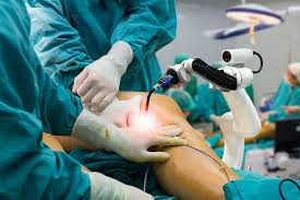 robotic_knee_replacement surgery
